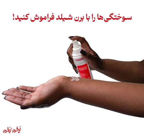 سوختگیها را با اسپری هیدروژل برن شیلد فراموش کنید!