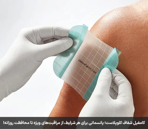 کامفیل شفاف کلوپلاست؛ پانسمانی برای هر شرایط، از مراقبتهای ویژه تا محافظت روزانه!