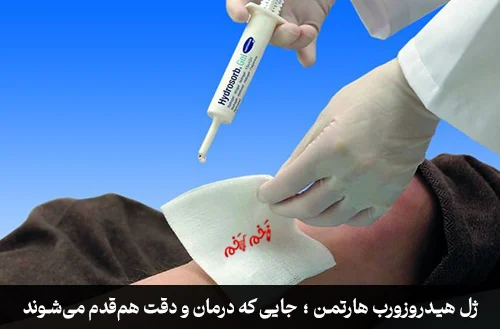 ژل هیدروزورب هارتمن ؛ جایی که درمان و دقت همقدم میشوند