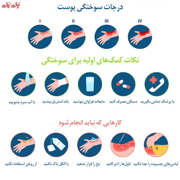 اینفوگرافیک درجات سوختگی پوست با فلز داغ + نکات کمک های اولیه برای سوختگی