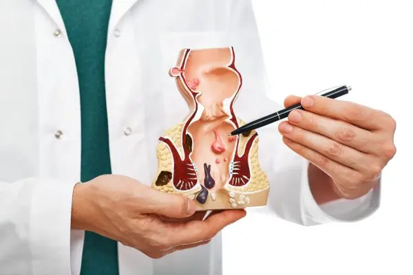 علائم شقاق مقعدی؛ نشانههایی که نباید نادیده بگیرید